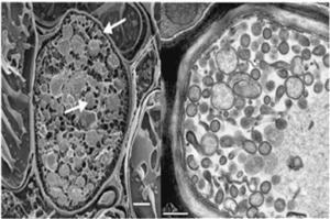 Figure 1 Electron microscopy picture (6000x) of a cross section of sieve tubes with phytoplasmas, modified from [8].