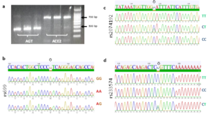 Fig. 1 Amplification and genotyping of AGT and ACE2 amplicons. a) Gel electrophoresis showing two amplicons, one with size between 200 and 300 bp (for AGT), and the other close to 700 bp (for ACE2). B-d) Sequencing chromatograms of rs699, rs2074192, and rs233574, respectively, with arrows pointing to the polymorphism site. 